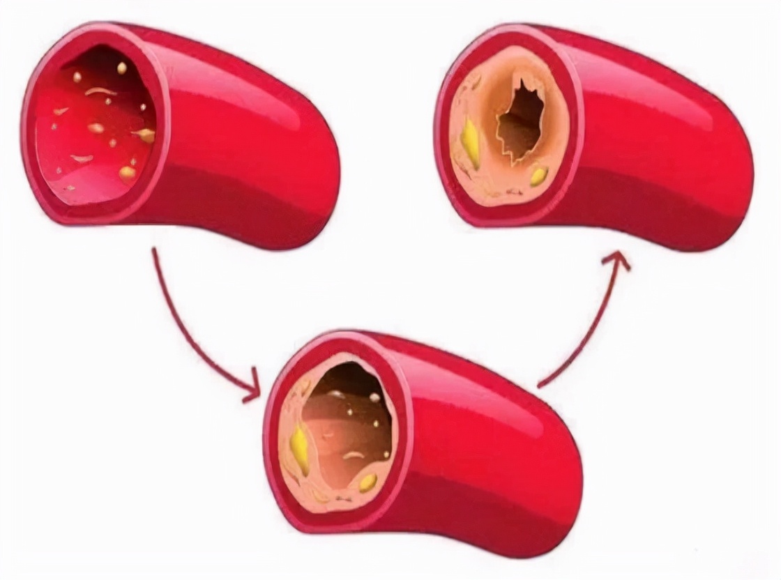 肝硬化身上长小红点痒是什么征兆,肝硬化脚面出了好多小红点有点肿