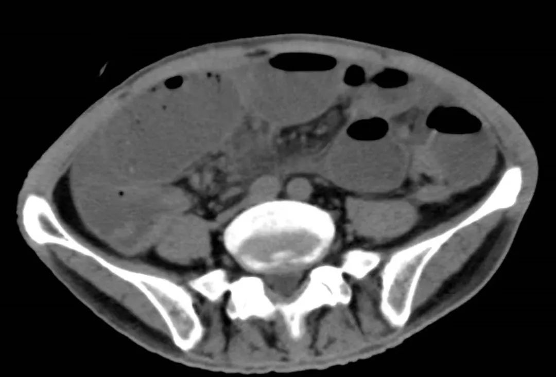 积水潭医院新龙泽院区急诊,北京积水潭医院骨科新龙泽院区