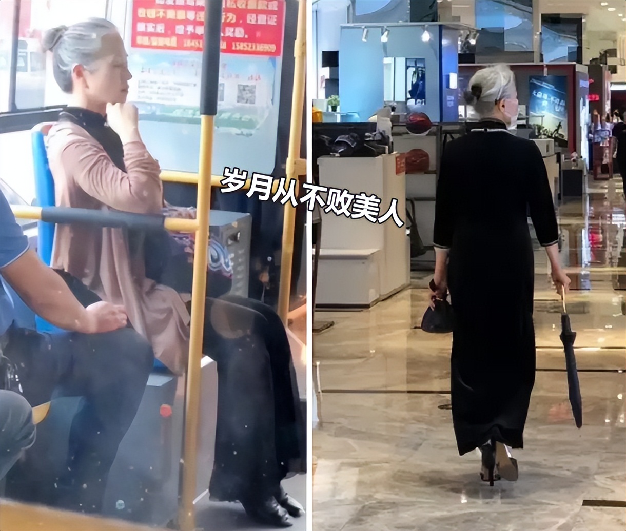 富贵包真的很丑吗,有富贵包会影响寿命吗