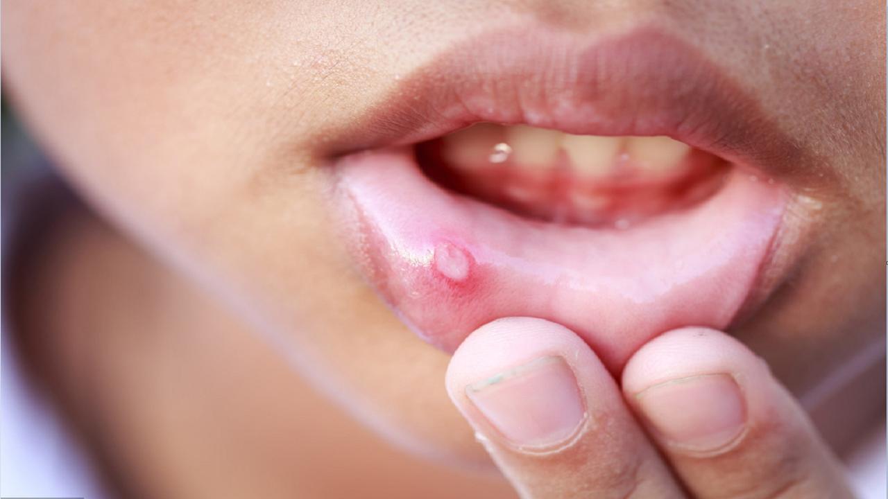 有这几种表现可能是得胃癌了,八个症状证明你体内有癌