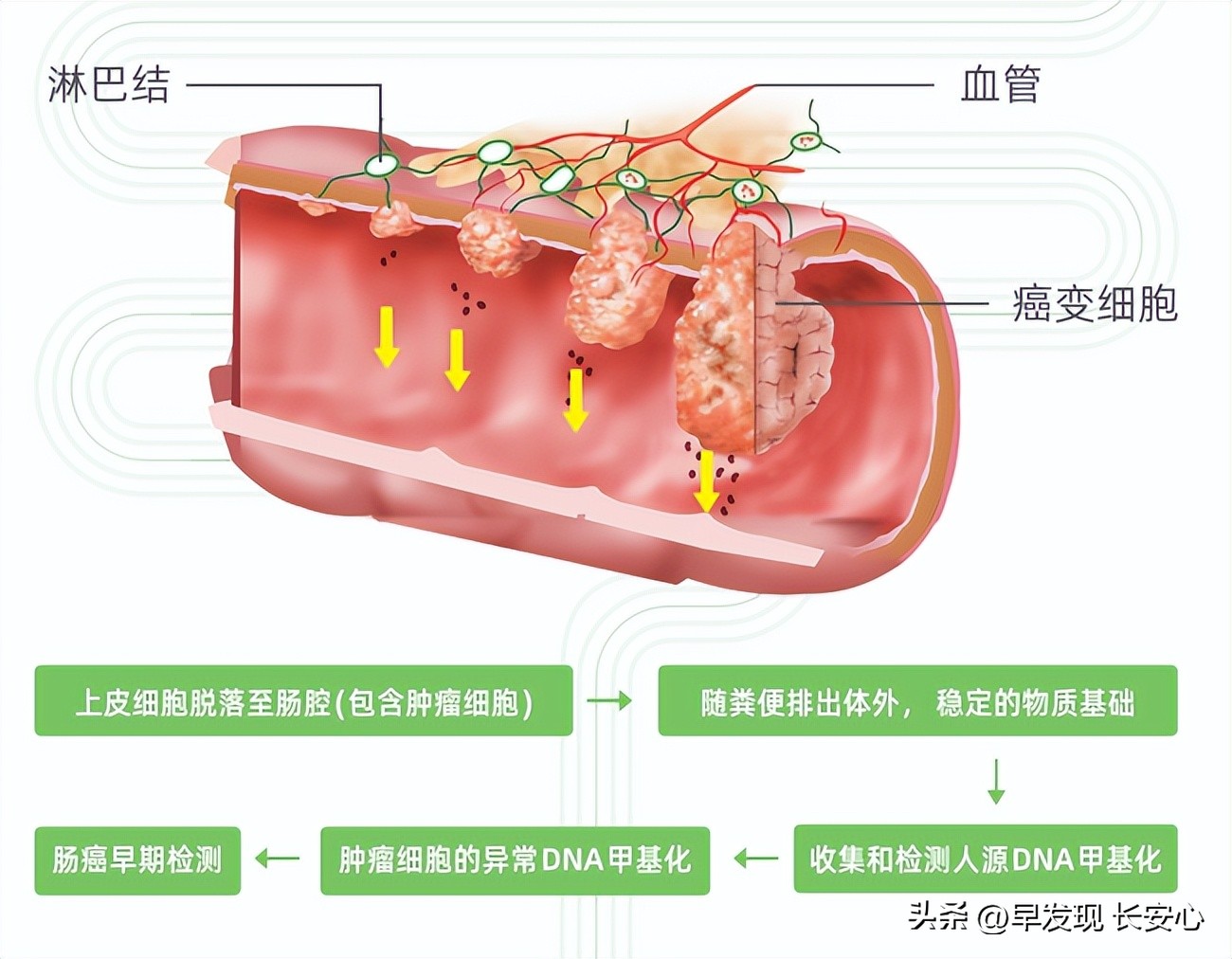 愿球王安息完整版,球王贝利最大的遗憾