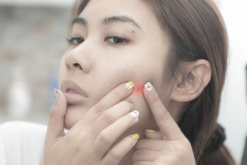 激素脸应该怎么正确的护理与治疗,想修复激素脸又害怕