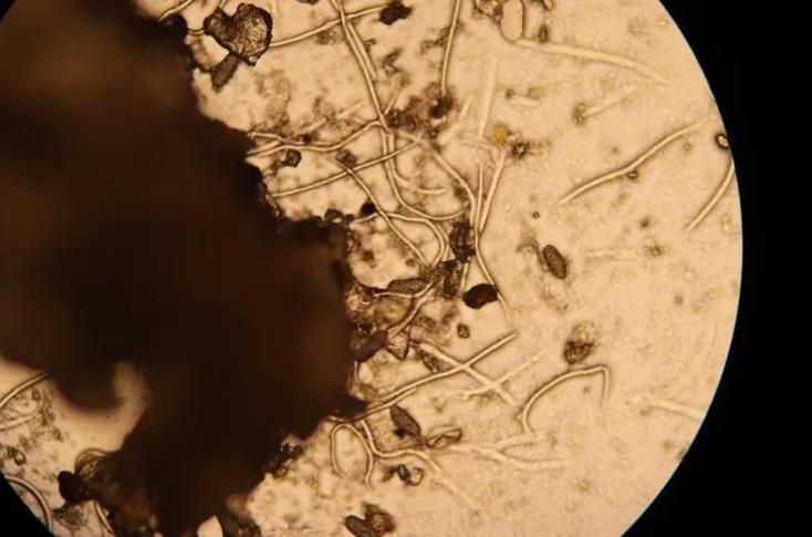 壳寡糖的促进生根作用,壳寡糖对免疫系统的调节作用