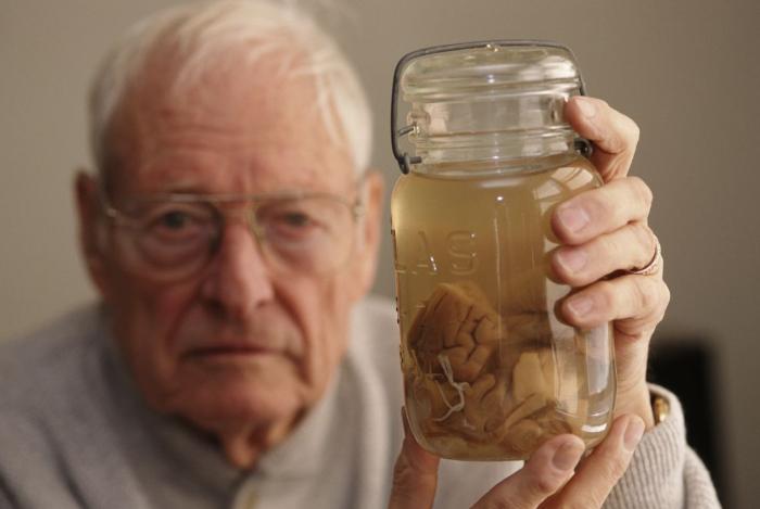 鐖卞洜鏂潶鍘讳笘瑙ｅ墫澶ц剳,鐖卞洜鏂潶澶ц剳涓㈠け涔嬭皽