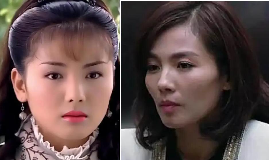 方脸和高颧骨怎么抗老,高颧骨好看还是低颧骨抗老