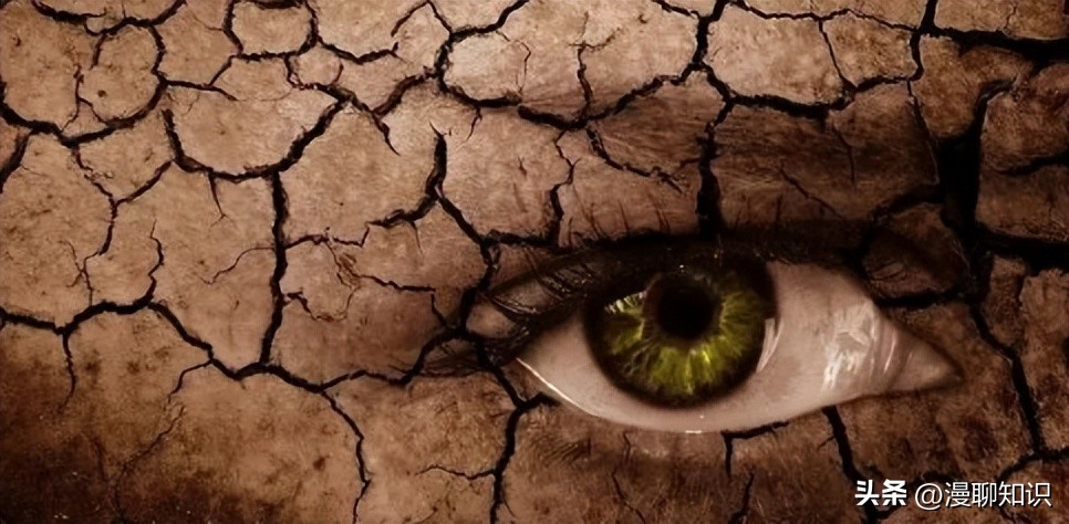 干眼就是干燥综合症吗,眼干涩视物模糊得了干眼怎么办