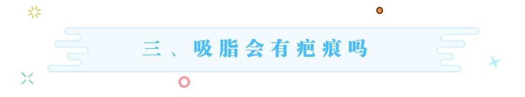 上海九院吸脂收费标准,九院韦敏面部吸脂
