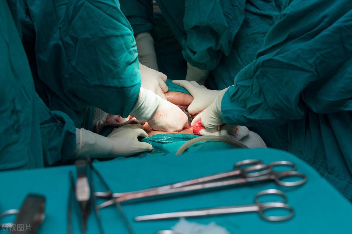 剖宫产后如何快速恢复调理身体,剖宫产术后怎么恢复最快