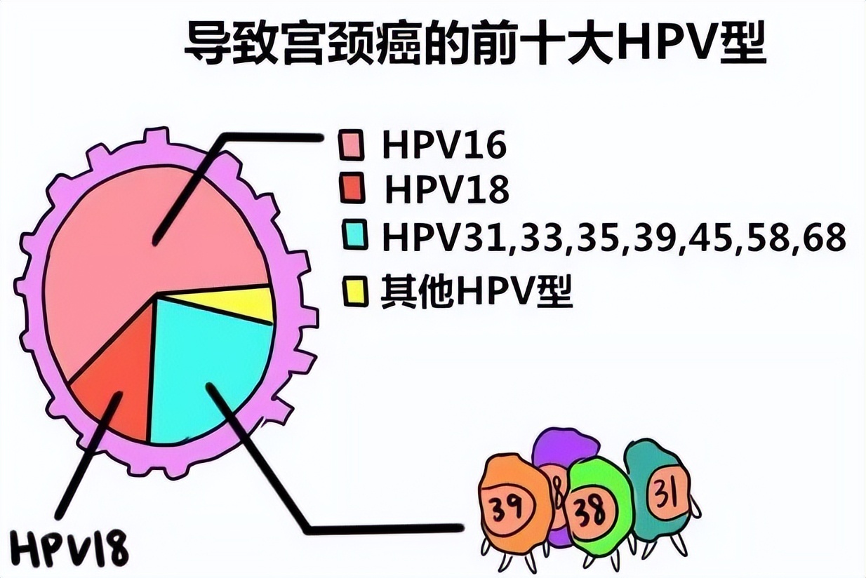 宫颈癌和HPV一样吗,宫颈癌和HPV检查是一样吗