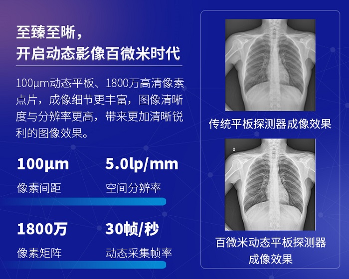 三维子宫输卵管超声造影临床应用,输卵管造影dr检查有辐射吗