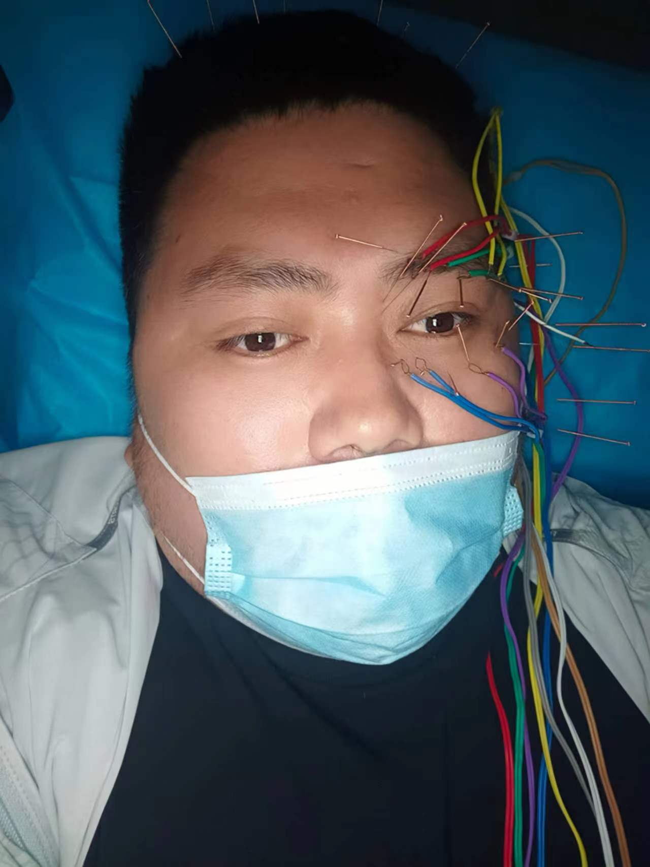 80后中年脑出血,80后脑出血患者