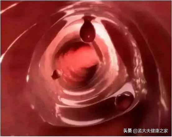 肛门掉出来肉球怎么治疗,肛门掉出紫色肉球怎么治疗