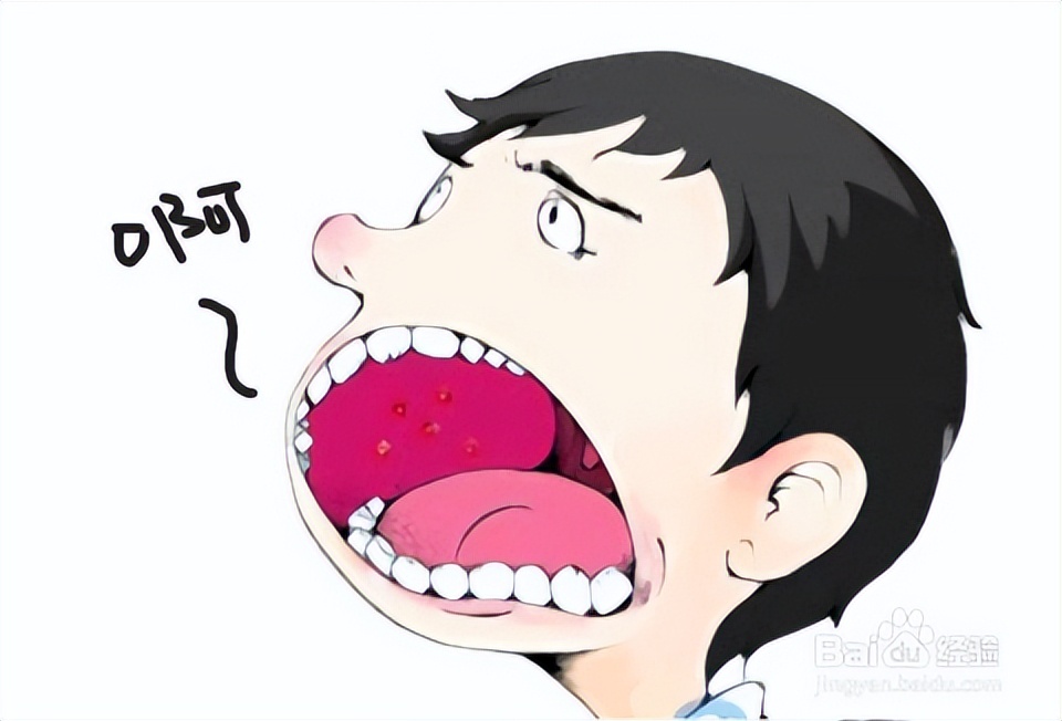 得了口腔炎日常做好这4点是关键