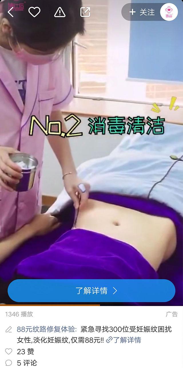 修复妊娠纹产品广告,妊娠纹修复广告义乌