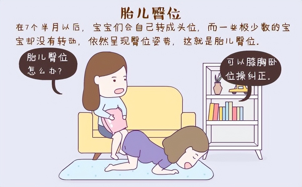 臀位39周胎儿偏小剖腹产安全吗,胎儿臀位会有临产征兆吗