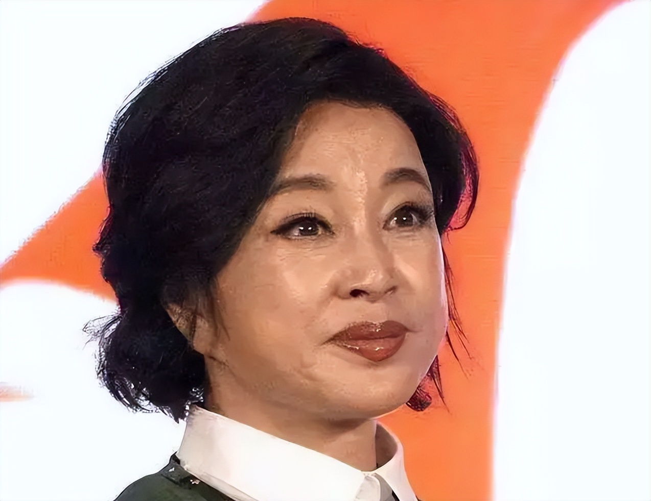 面部衰老皱纹解剖图,面部皱纹衰老对比图