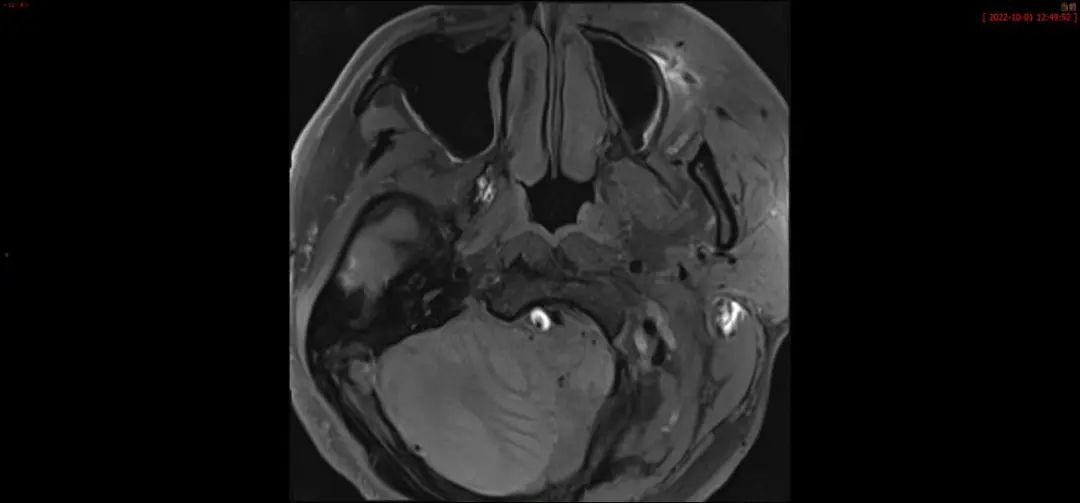 广元首台！智慧感知生命开启“设备配合病人”新时代