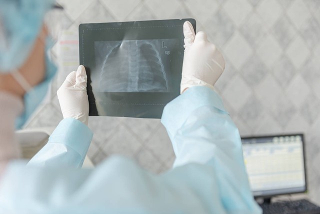 小儿肺部感染引起间质性肺炎原因,肺部感染的正确诊断及编码原则