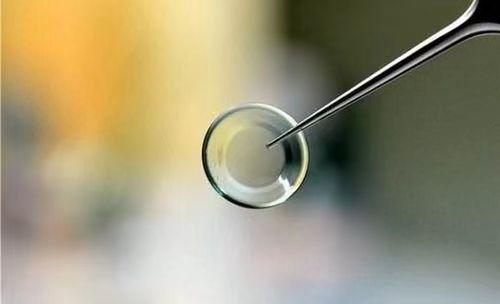 角膜塑形镜戴了8年停戴反弹1000度 (为什么孩子戴角膜塑形镜效果很差)