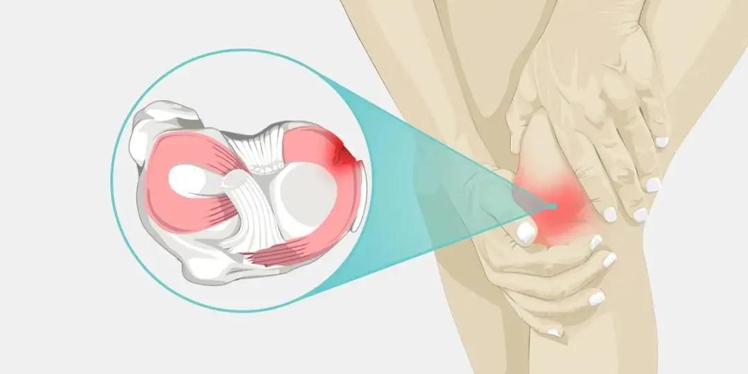 孩子膝关节响是怎么回事,小孩膝关节运动就响是怎么回事