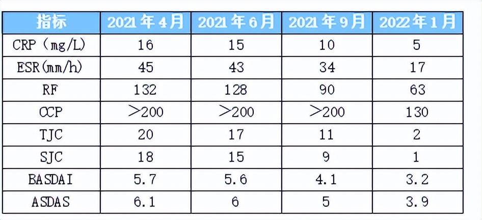 阿达木单抗治疗强直性脊柱炎案例,类风湿合并强直哪个药最好