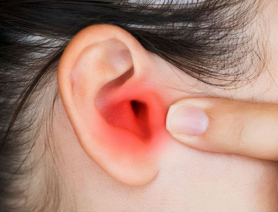 小时候耳朵流脓导致现在听力不好,耳朵痛流脓有什么药可以治好