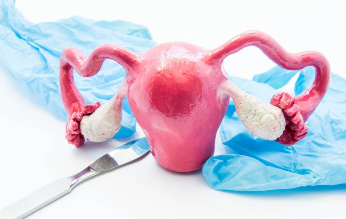 宫腔镜手术是什么？令诸多女性“谈腔镜色变”的手术能查出什么？