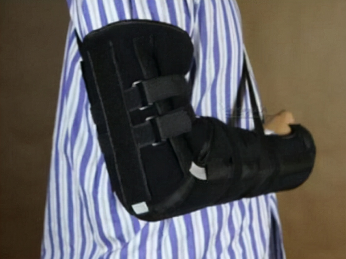 肘关节骨折康复训练器,肘关节骨折康复治疗方案