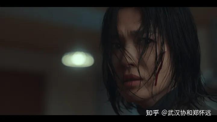 文东恩的伤疤令人心惊，身上的兽皮痣到底要不要治？