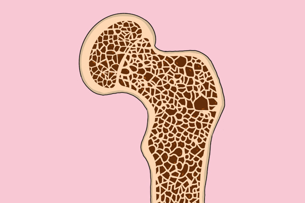 增强骨密度会影响什么医生怎么说,骨密度下降该吃什么