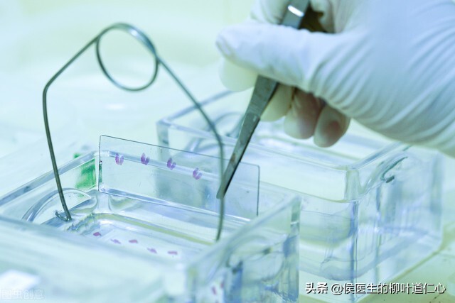 这例“被肺癌”的结节，手术不过度，但完全可以延迟在疫情后