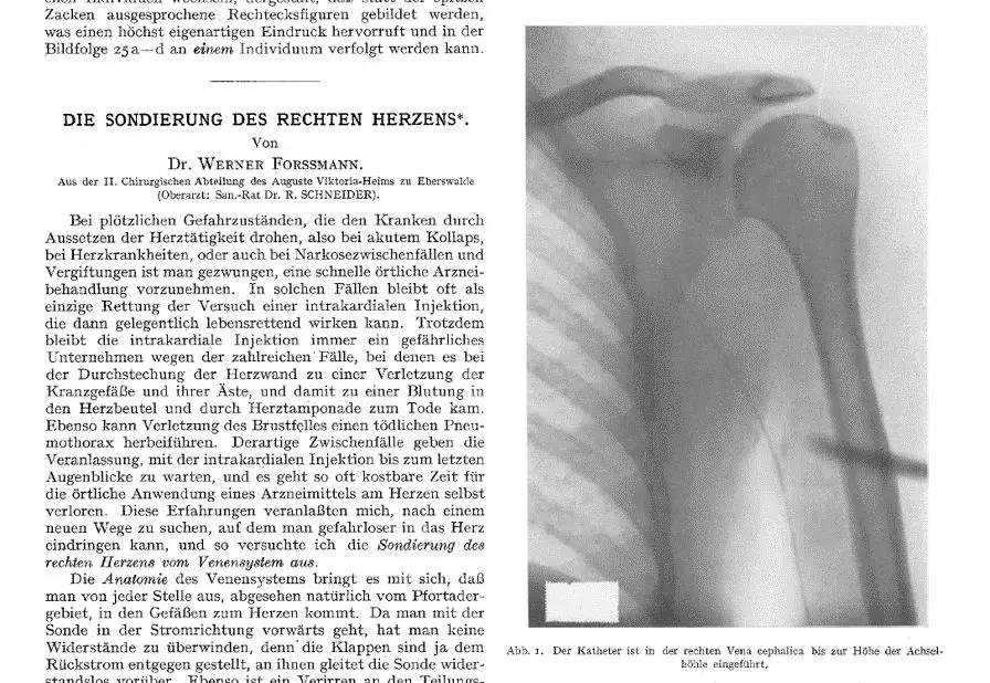 心血管医生第一人视频,中国医生第一个插管成功的人