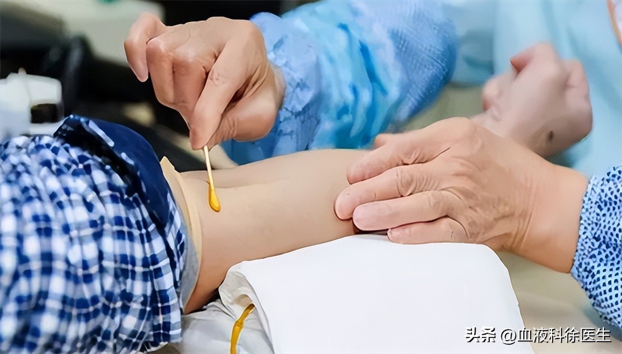 血糖高的人建议吃水果吗,血糖高的人吃水果注意什么