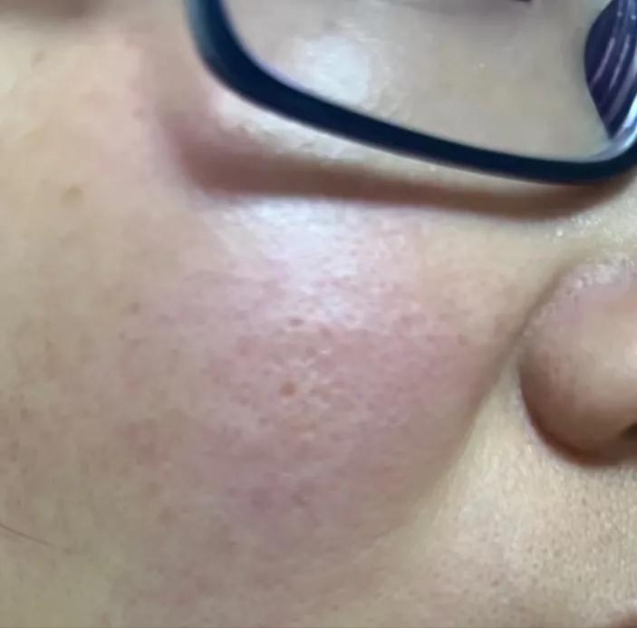 为什么用完洗面奶脸部泛红起皮,为什么用完洗面奶后脸更黑了