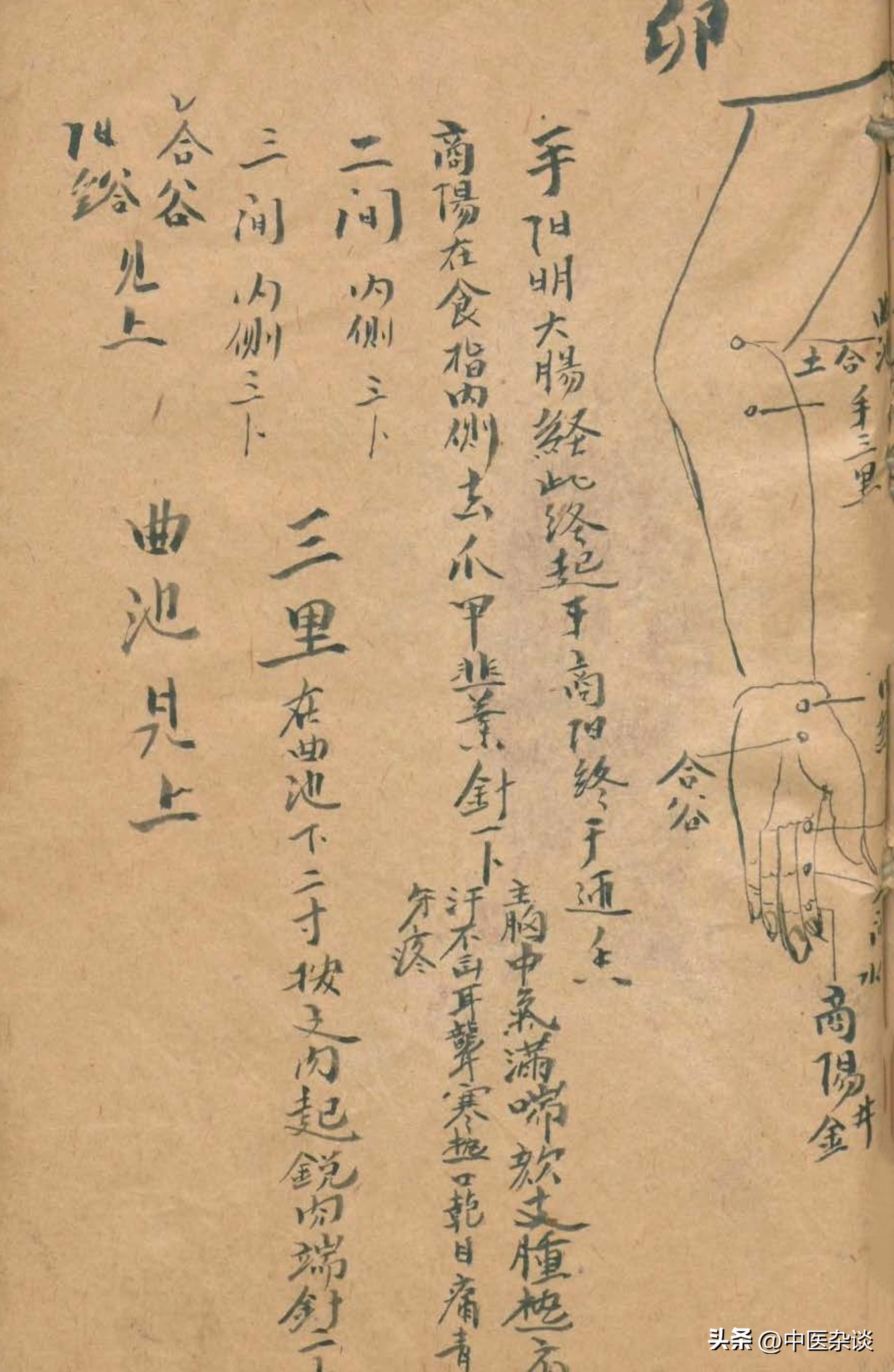 中医针刺放血疗法书,中医放痧口诀大全