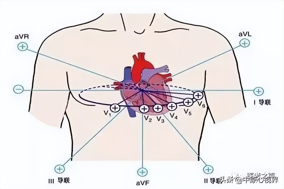 护考几种常见的心电图,常见的心电图图形分析