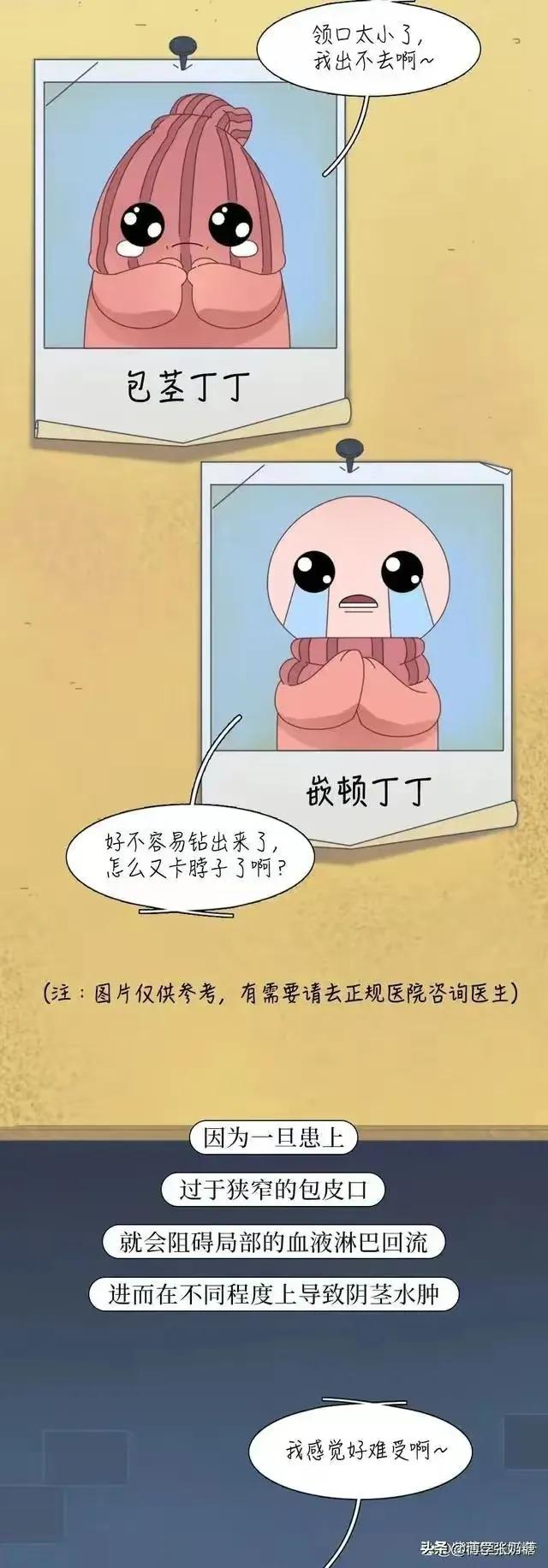 男生包皮手术水肿怎么办,男士做包皮手术多年后遗症呢