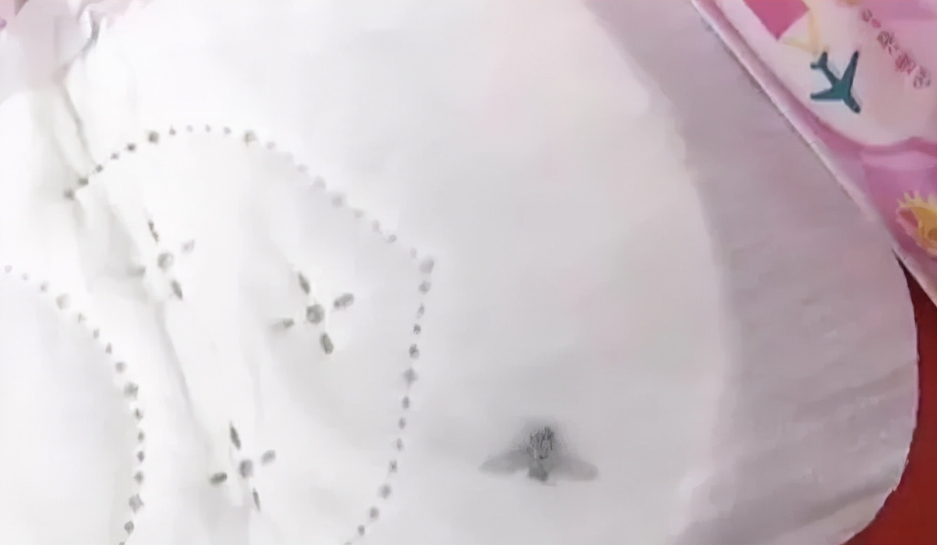 卫生巾内发现虫卵,卫生巾有细扁的小虫子