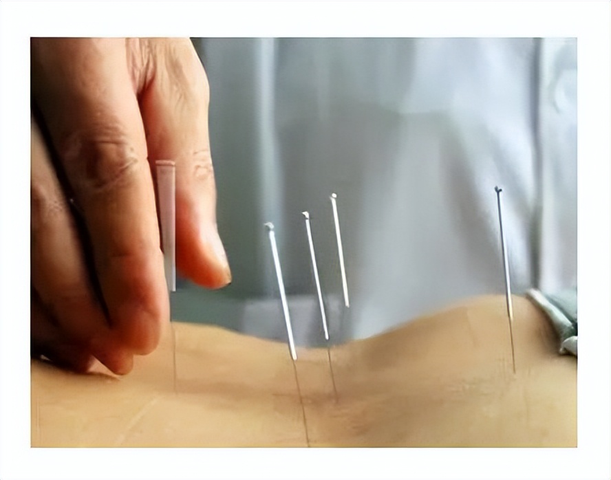 医学科普腰痛的原因 (健康医学科普知识腰痛)