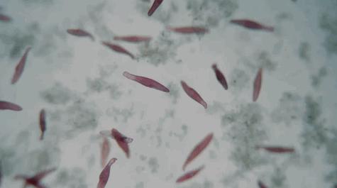 睡觉每晚都磨牙到底是什么原因,夜里睡觉一直磨牙是什么原因