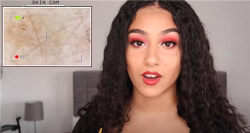 对水过敏的人怎么喝水,怎么会对水过敏