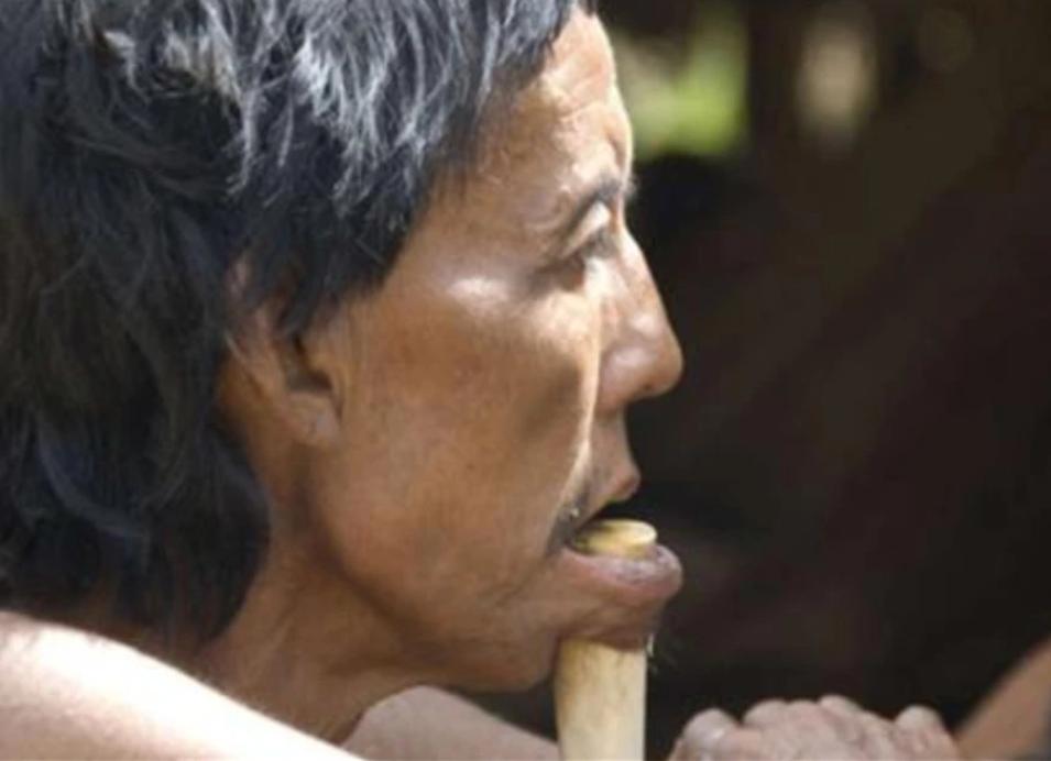 以“裸为美”部落，无论老少都下巴插木棍，这种陋习为啥还存在？