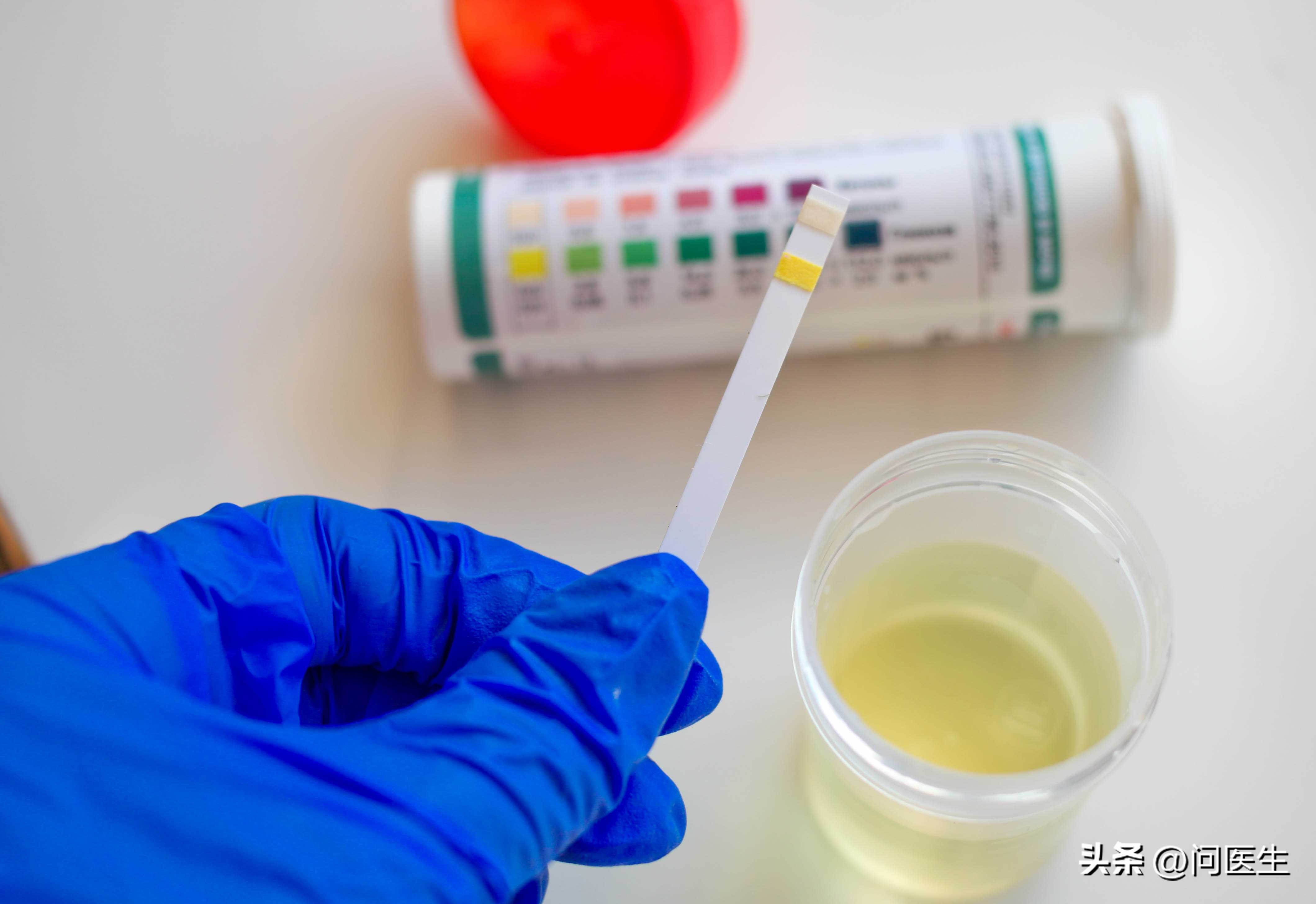 这段时间老是尿频怎么办,尿频怎么办老上厕所