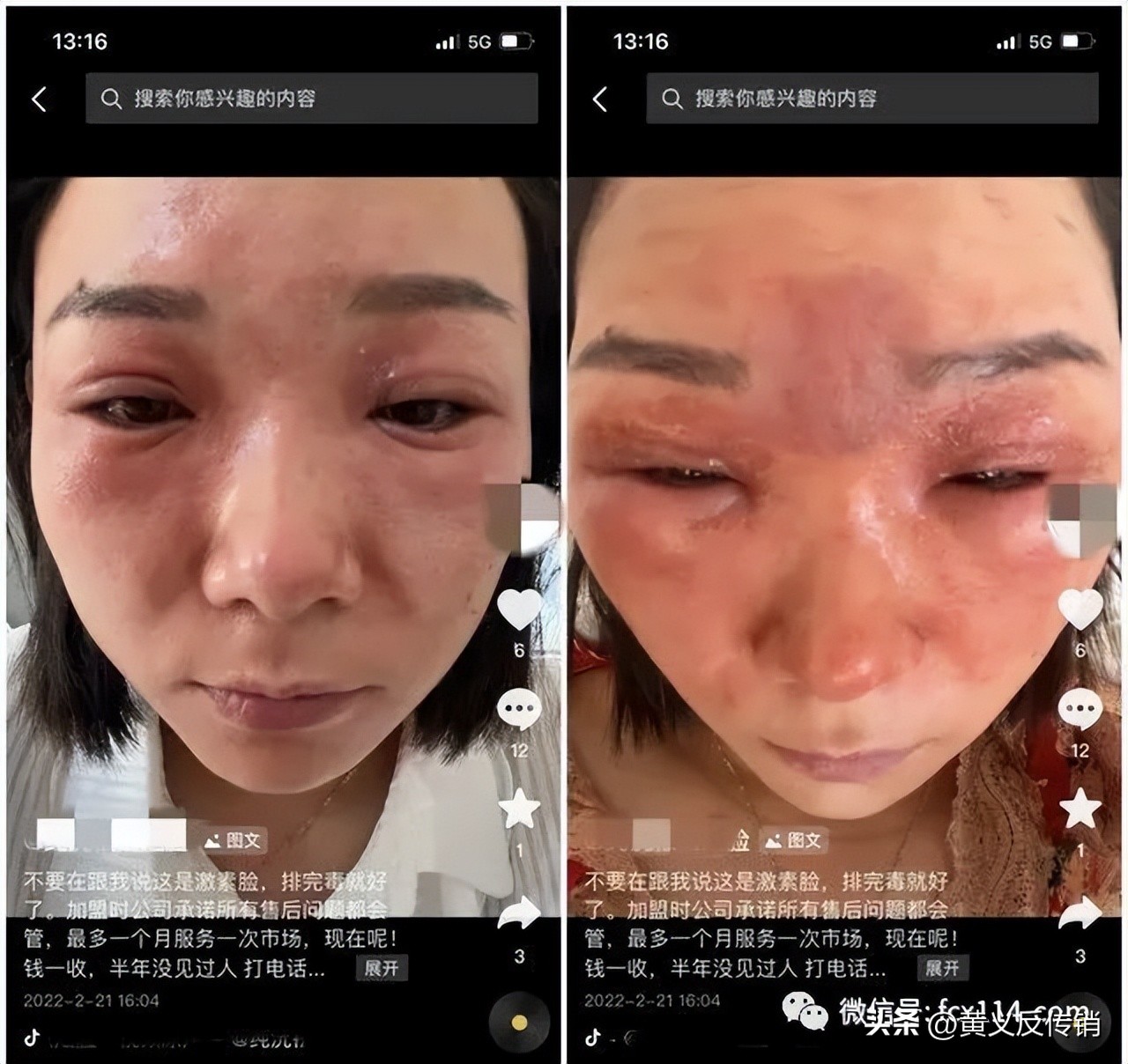 马上购纯沅祛斑骗局,马上购是传销吗