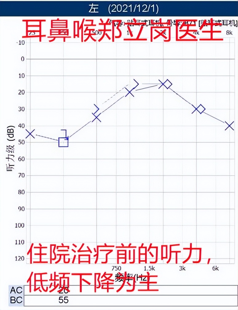 一侧耳朵闷堵听力下降可以自愈吗,突然耳朵堵住的感觉怎么解决