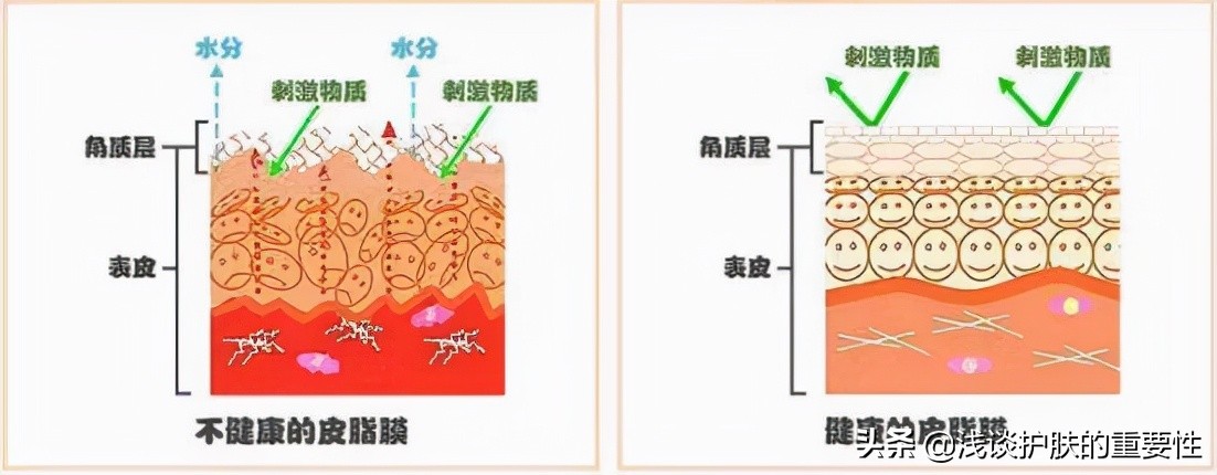 冬天皮肤干燥夏天出油用什么保湿,冬季油性皮肤干燥怎样补水更有效