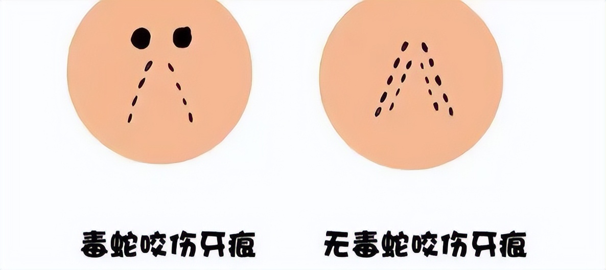 当心蛇出没,夏天蛇多如何防蛇避蛇