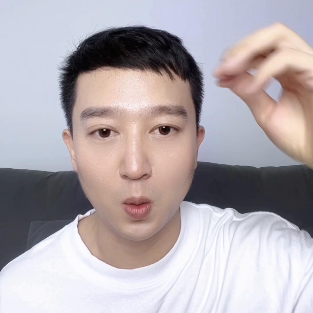 遗传秃头一般什么时候秃,秃头是遗传怎么治疗