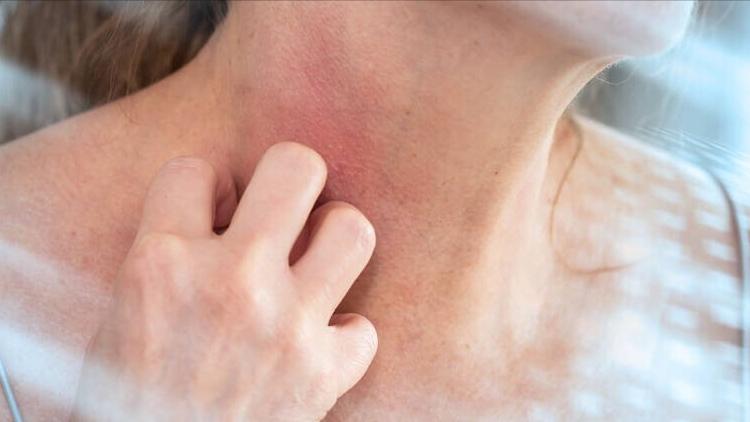 益母草治疗哪种妇科疾病,益母草妇科调经