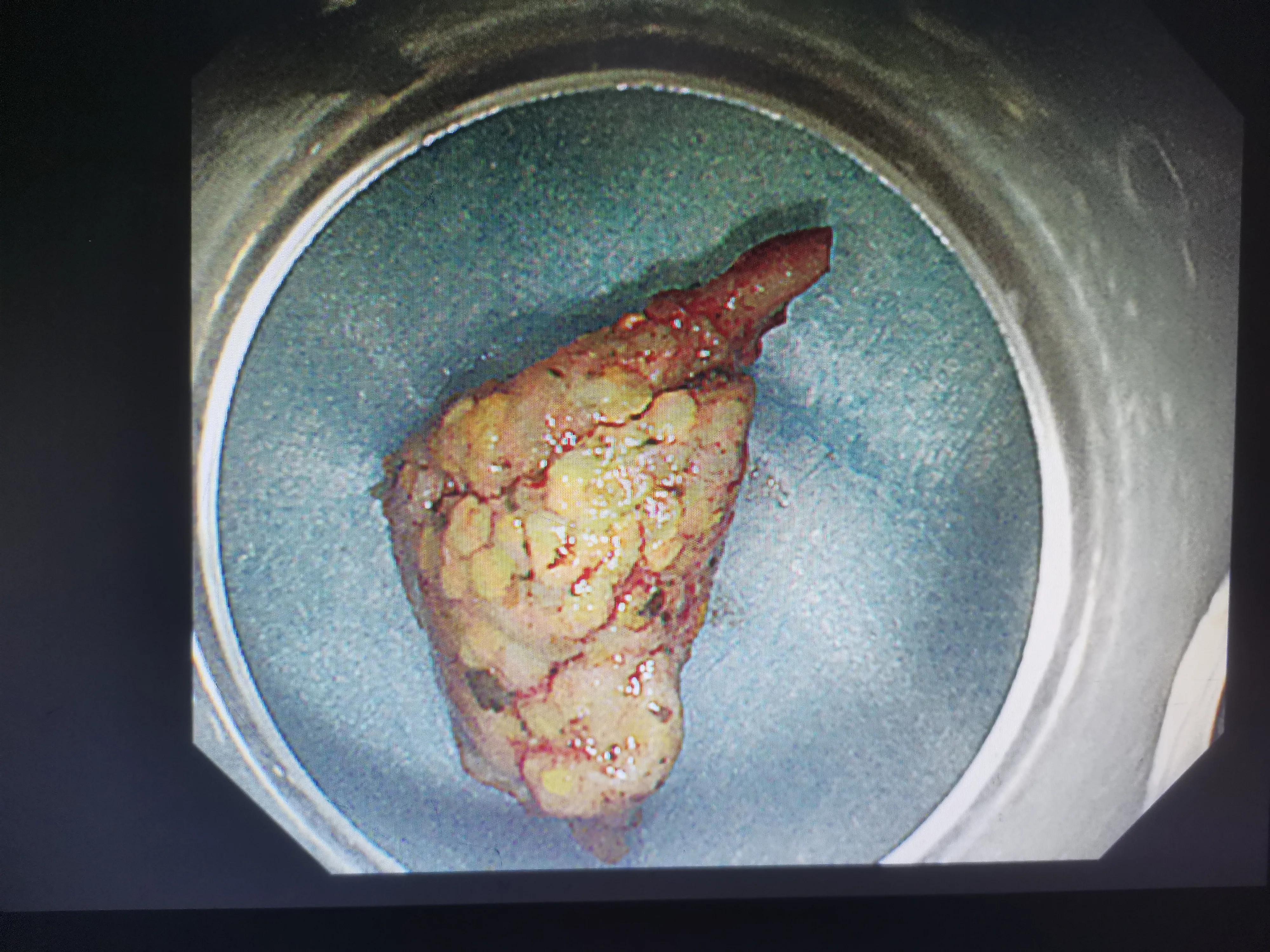 痛惜完整版原唱,痛惜和惋惜的区别